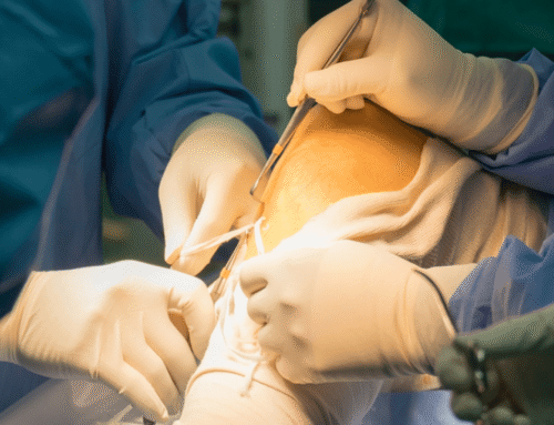 Best Hospital to Get an ACL Reconstruction in the Philippines
