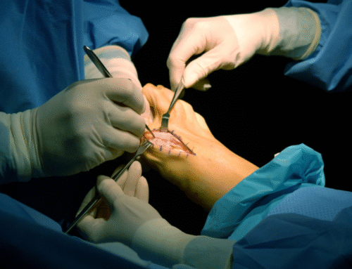 Why Consulting a Hand Specialist Matters for Lasting Relief and Mobility
