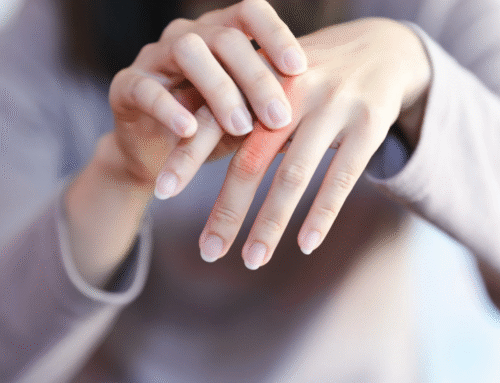 Common Trigger Finger Symptoms and How Orthopedic Care Can Help Restore Mobility