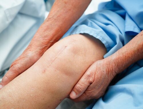Restoring Mobility and Confidence with Total Knee Replacement by Dr. Tec